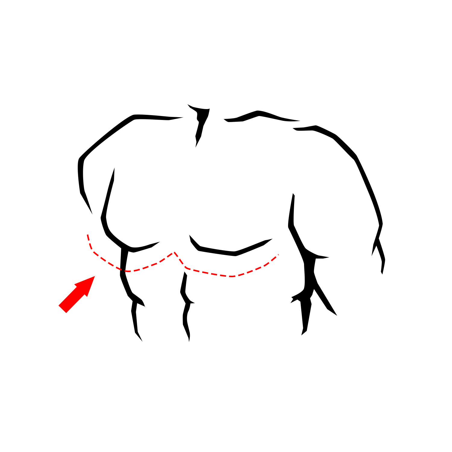 Chest