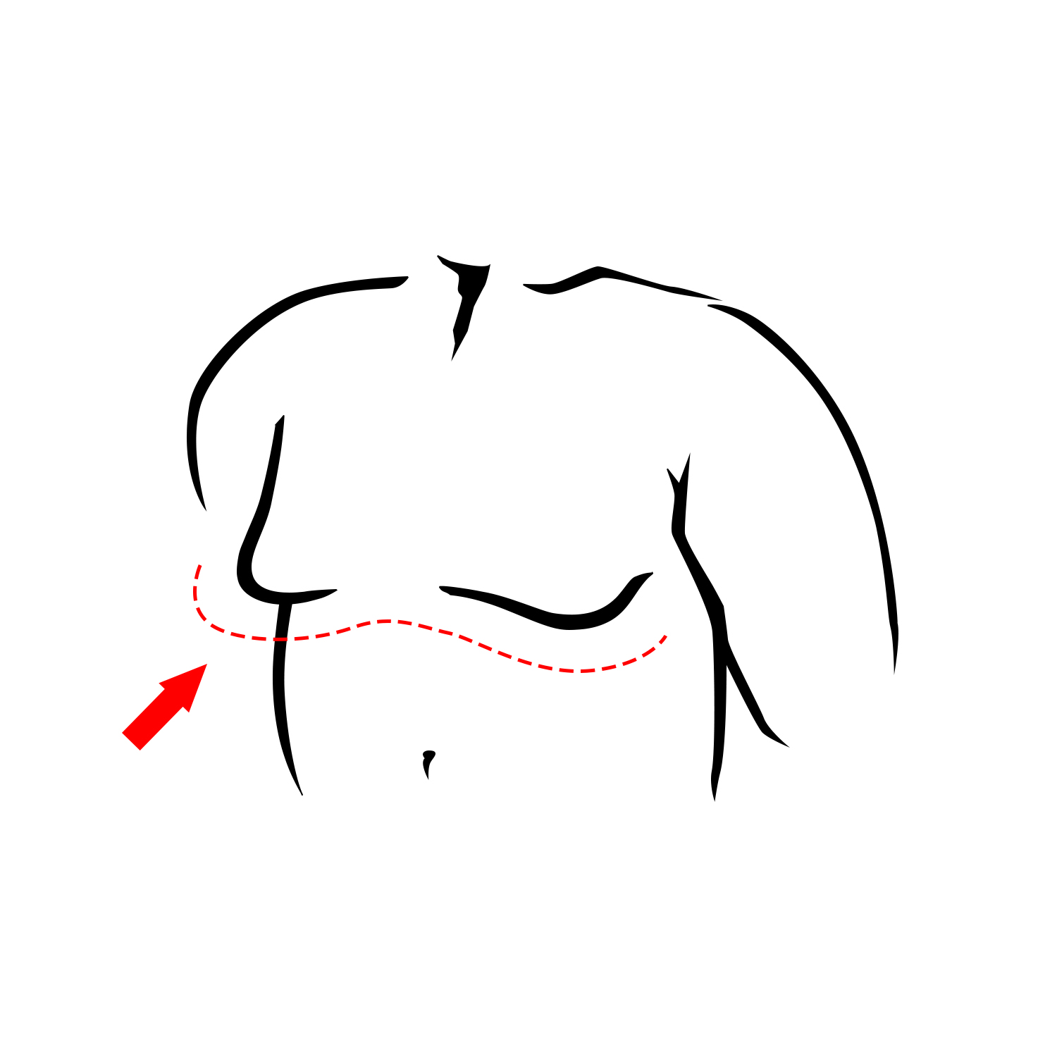 Chest